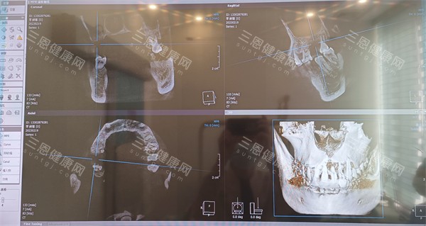 珠海仁爱口腔CT展示 珠海仁爱口腔CT展示