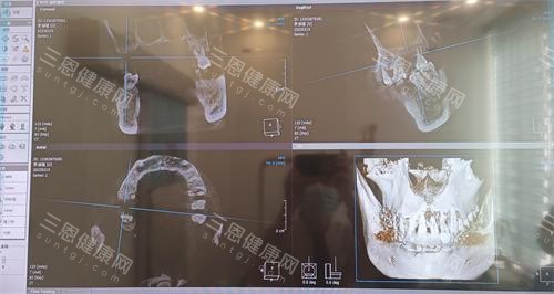 珠海仁爱口腔牙齿拍片