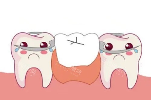 活动假牙安装卡通图 活动假牙安装卡通图