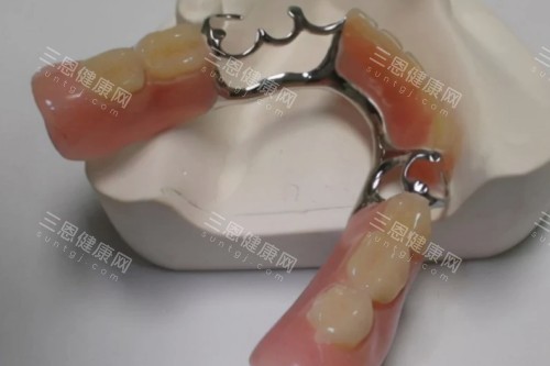 活动假牙模型图片展示 活动假牙模型图片展示