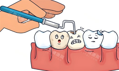 补牙手术项目动画