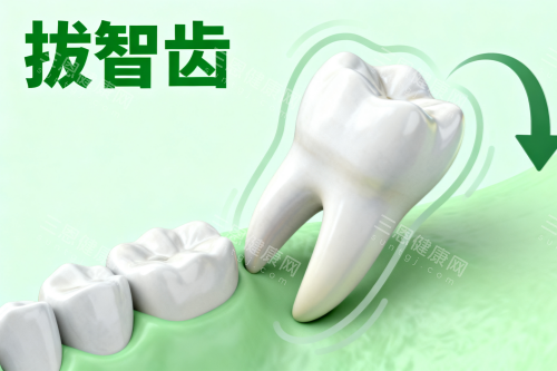 阻生智齿卡通展示图