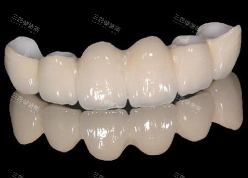 半口全瓷牙展示图 半口全瓷牙展示图