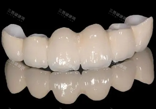 愛迪特VS愛爾創全瓷牙，價格同美學嘅大戰