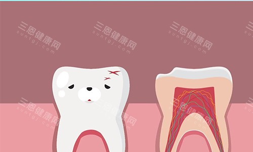 根管治疗的流程示意图