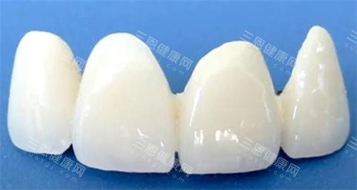 国产美晶瓷全瓷牙
