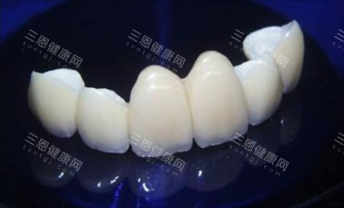 愛迪特全瓷牙質素點樣？國產頂級材料+5大核心優勢大揭秘