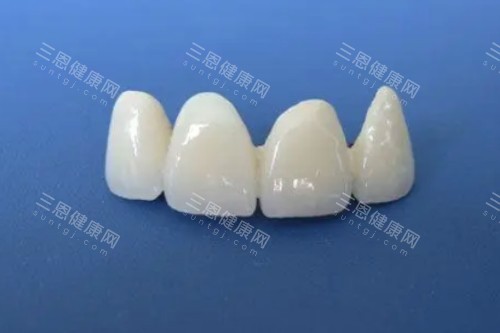 全瓷牙模型展示图