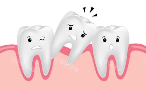 門牙太稀疏如何矯正？可靠評估是關鍵，4類方案適配不同牙齒條件